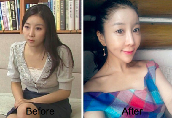 韓國少女整型前和整型後！你會喜歡那個？
