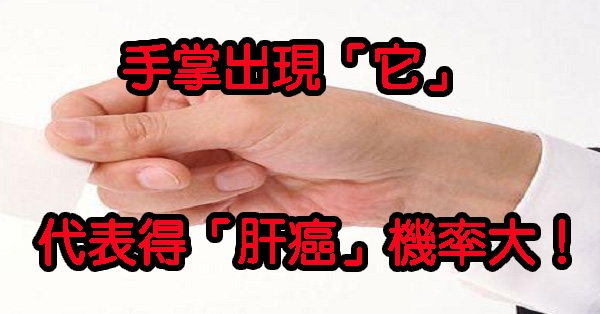 手掌出現「它」，代表罹患「肝癌」機率大！快檢查看看你有嗎？