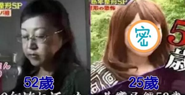 為了養家賺錢，她三年內動刀20次從「52歲」整成「25歲」！所有人看到她現在的樣子都跪了...