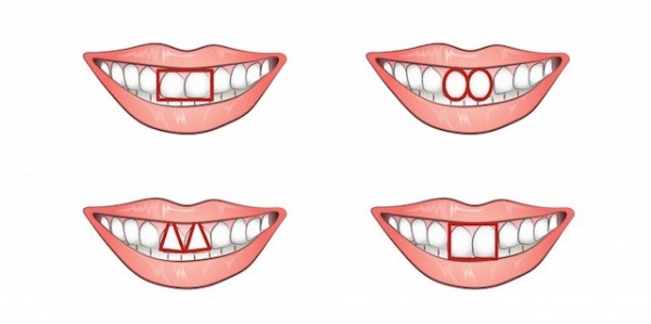 你的「門牙」是什麼形狀的呢？沒想到這其中居然隱藏著生命的秘密，難怪「大老闆」都是這一型的！